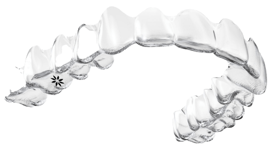 Clear aligner tray