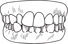 Crooked teeth treatment form