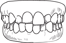 Crossbite treatment form