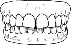 Tooth gap treatment form