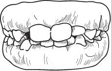 Mixed primary and permanent teeth orthodontic treatment form