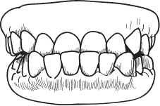 Underbite treatment form