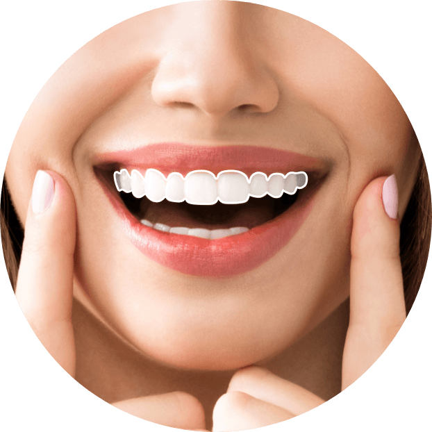 Smile with demonstration of clear aligners