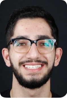 Young man with glasses smiling after orthodontic treatment in Queens