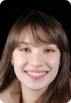 Young woman grinning after orthodontic treatment in Queens