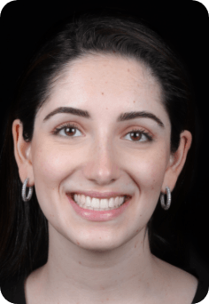 Woman with earrings smiling after Queens orthodontic treatment