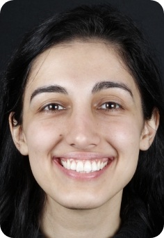 Young woman grinning after seeing her Queens orthodontist