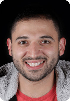 Young man in fleece jacket smiling after orthodontic treatment in Queens