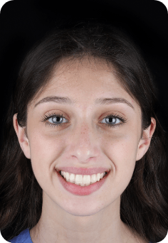 Young woman grinning after visiting Queens orthodontist