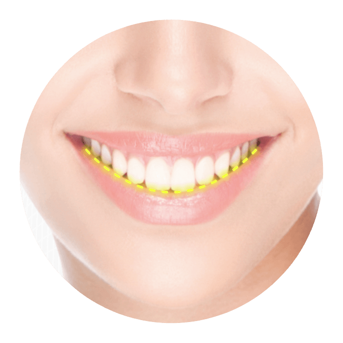 Closeup of face showing smile arch