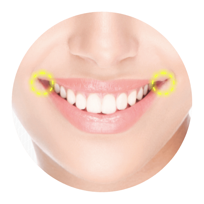 Closeup of face showing smile width