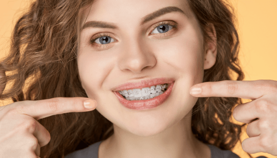 Woman with clear and ceramic braces pointing to smile