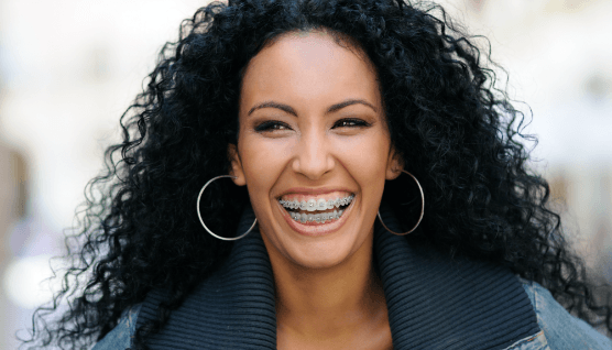 Woman with self ligating braces smiling