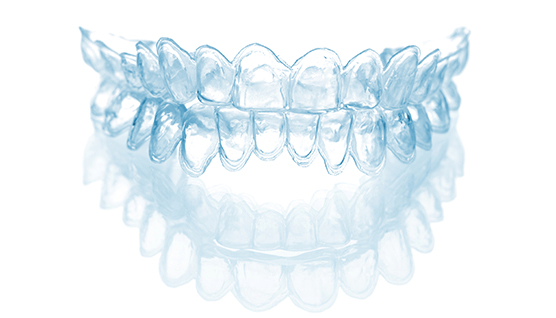 Indirect bracket aligners