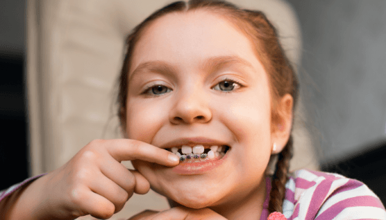 Child with early interception orthodontic treatment pointing to teeth