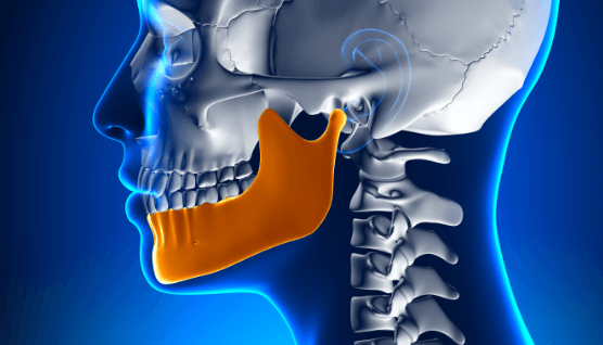 Animated jaw and skull showing the results of surgical orthodontic treatment